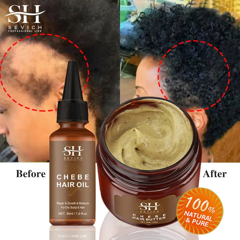 Alopecia Treatment Oil Natural Crazy Hair Regrowth