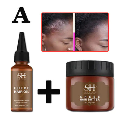 Alopecia Treatment Oil Natural Crazy Hair Regrowth